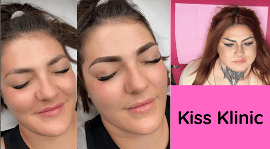 Lip fillers